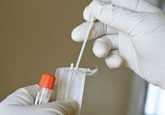 Medical assistant opening COVID-19 or flu rapid test nasal swab at Fairmont Family Practice in La Porte, TX.